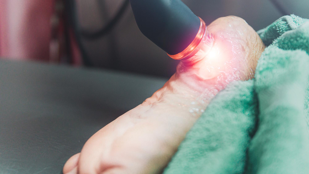 Shockwave Therapy (EPAT/ESWT)